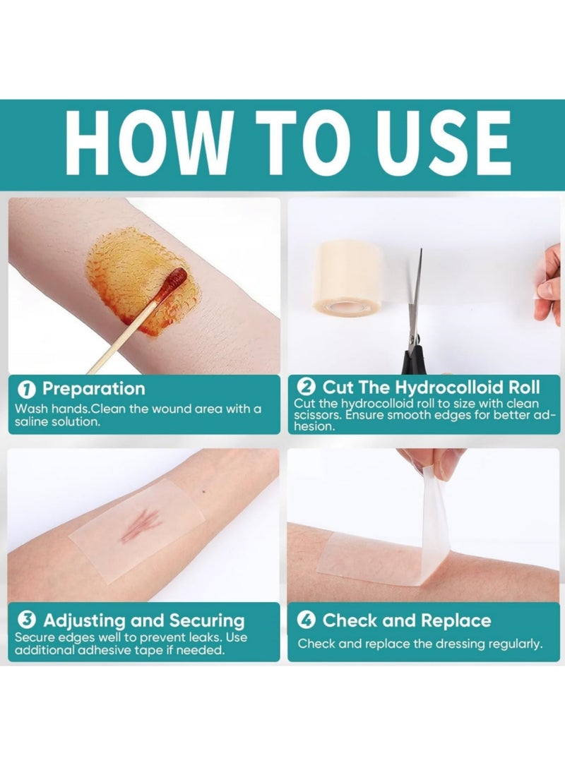 saykfoe 5cmx1.5m Hydrocolloid Bandage, Wound Care Hydrocolloid Roll, Cut-to-size Waterproof Tape,Portable Gentle Breathable Bandage,suitable For Sensitive Skin Hands Feet Toe Face Pimple - Image 4
